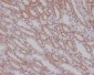 Anti-Smad3 Rabbit Monoclonal Antibody